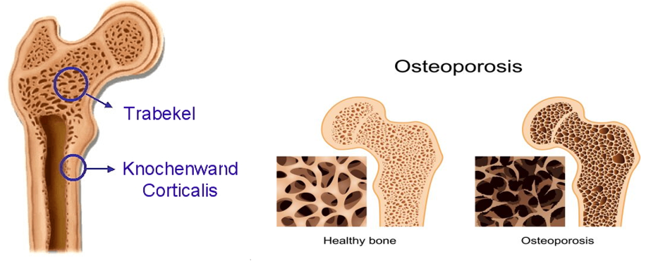 bonestructure